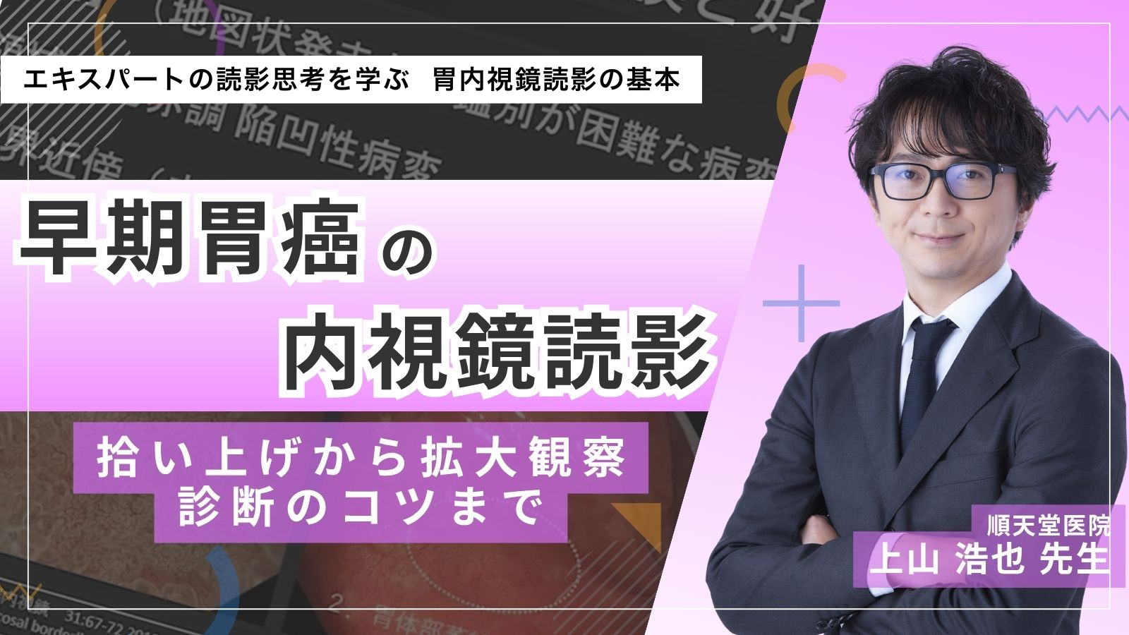 早期胃癌の内視鏡読影　拾い上げから拡大観察、診断のコツまで