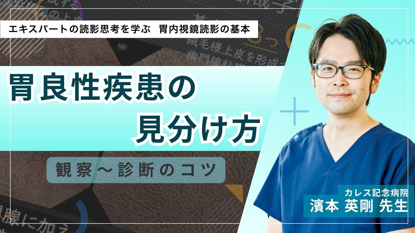 胃良性疾患の見分け方　観察～診断のコツ