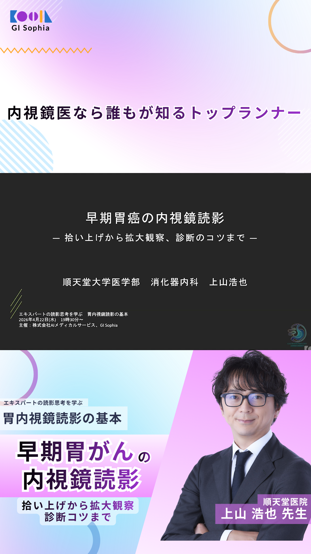 早期胃癌の内視鏡読影　拾い上げから拡大観察、診断のコツまで