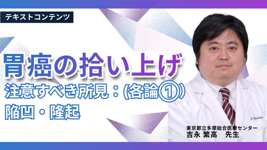 胃癌の拾い上げ　注意すべき所見（各論①）：陥凹、隆起