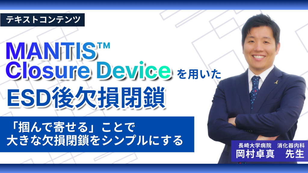 MANTIS™ Closure Deviceを用いたESD後欠損閉鎖―「掴んで寄せる」ことで大きな欠損閉鎖をシンプルにする―