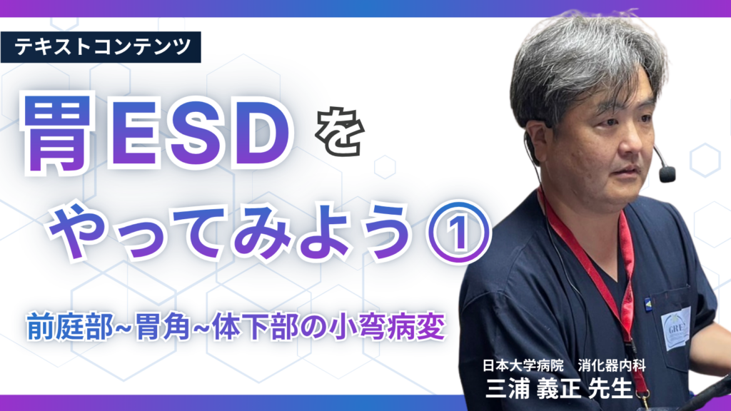 胃ESDをやってみよう①　前庭部~胃角~体下部の小弯病変