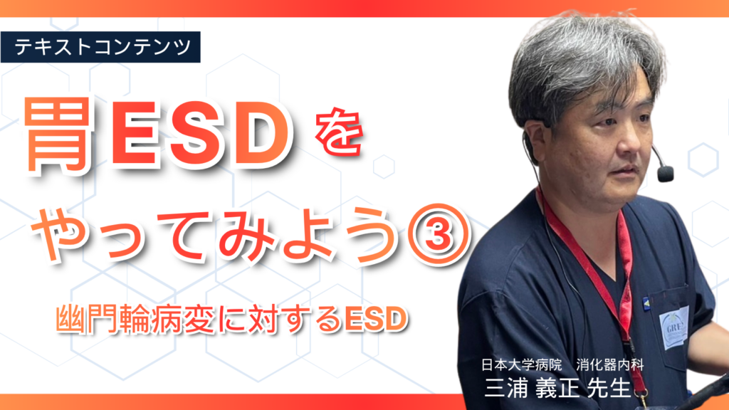 胃ESDをやってみよう③　幽門輪にかかる病変